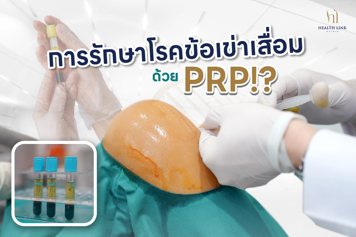 ปวดเข่า รักษาเข่าเสื่อม PRP ไม่ต้องผ่าตัด