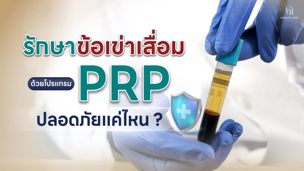 แบนเนอร์โปรโมทการรักษาข้อเข่าเสื่อมด้วยโปรแกรม PRP ของคลินิก Health Link ภาพประกอบด้วยมือที่สวมถุงมือสีฟ้าถือหลอดทดสอบที่มี PRP (Platelet-Rich Plasma) พื้นหลังเป็นภาพเบลอของแพทย์ในชุดขาว ข้อความในภาษาไทยเน้นถึงการรักษาข้อเข่าเสื่อมด้วย PRP และสอบถามถึงความปลอดภัย โลโก้ของคลินิก Health Link ปรากฏอยู่ที่มุมขวาบน